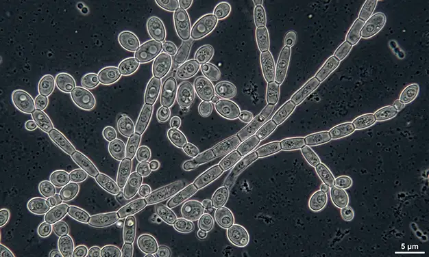 Photo du champignon candida albicans